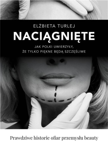 Naciągnięte, Elżbieta Turlej